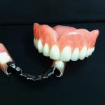 prothèse dentaire partielle