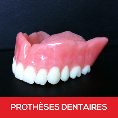 Prothèse Dentaire Complète - Sirois Denturologistes